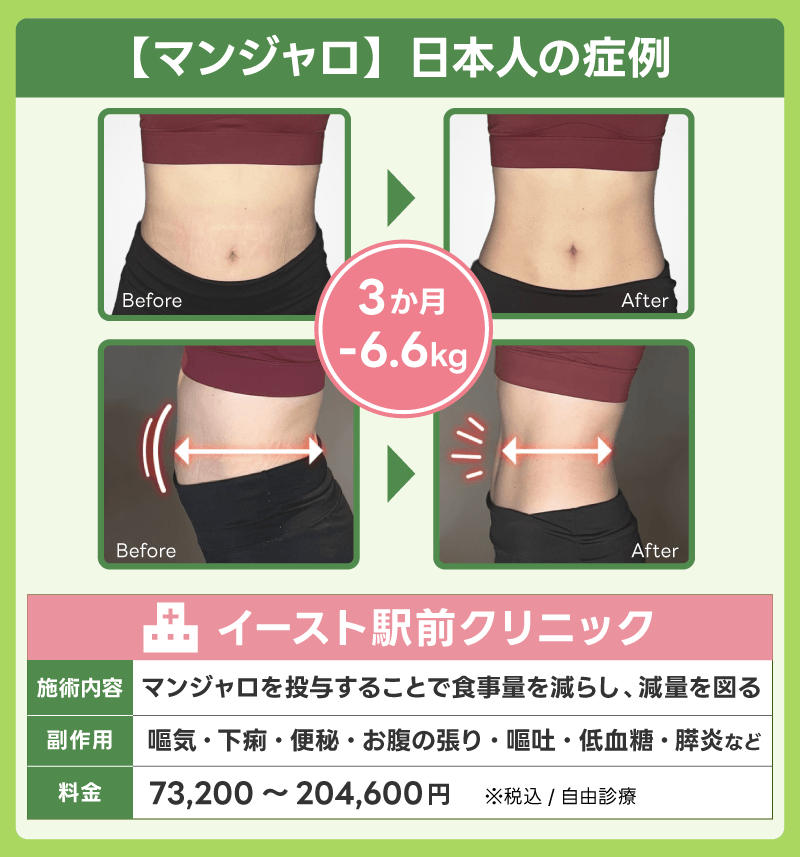 マンジャロ 症例