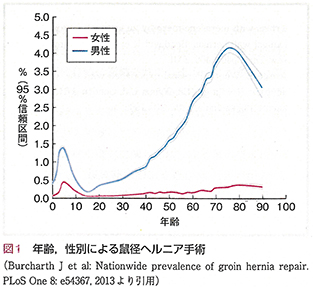 年齢・性別による鼠径ヘルニア手術