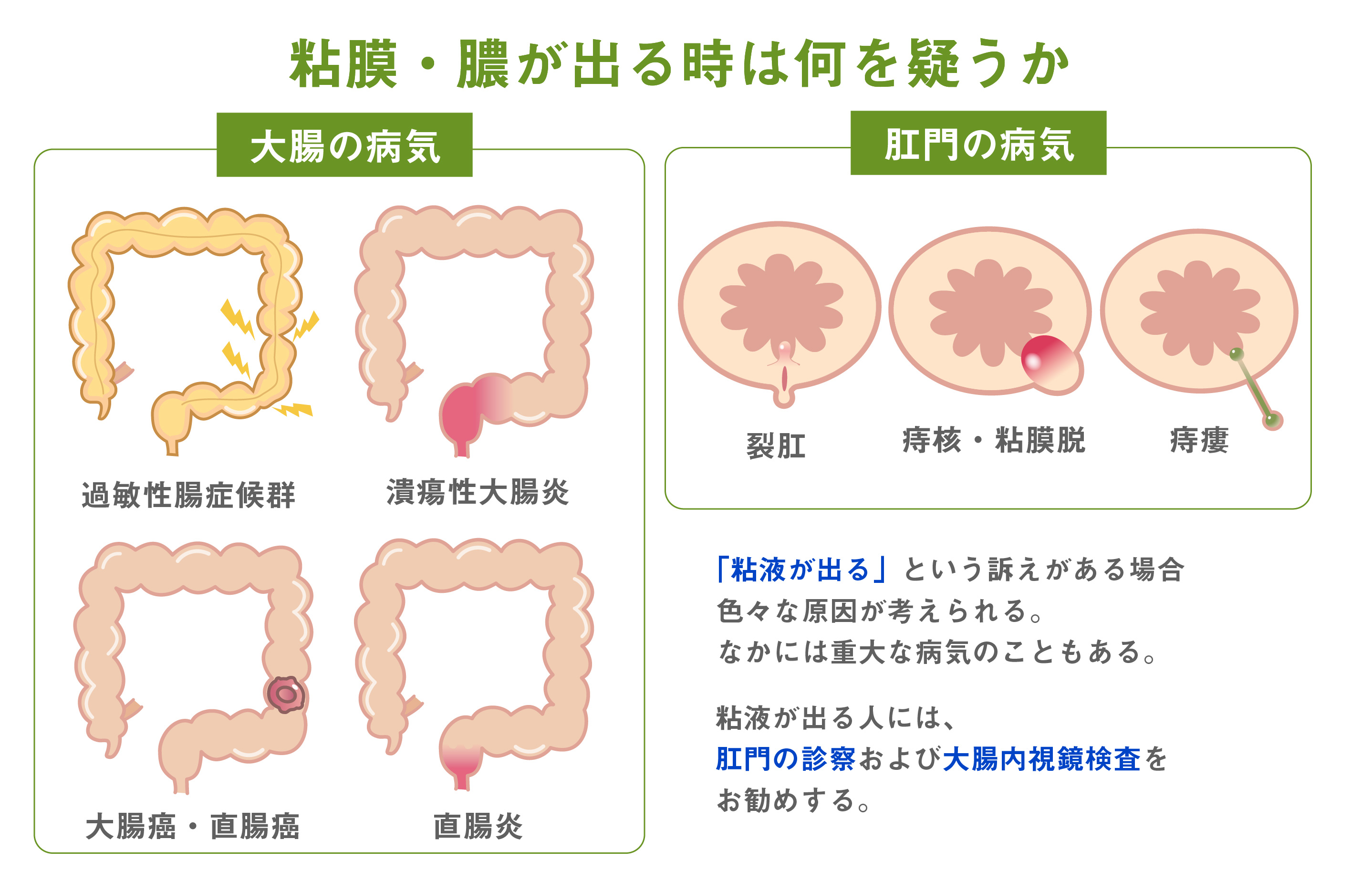 痔 の 日帰り 手術 長野 県