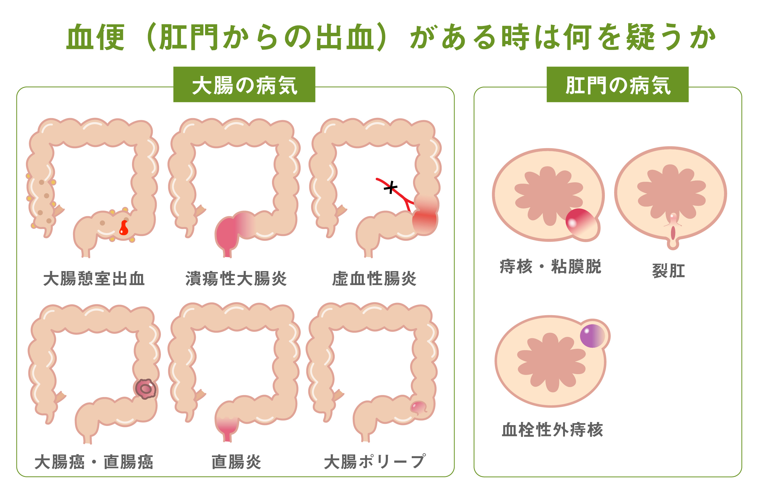 痔 は 何 科