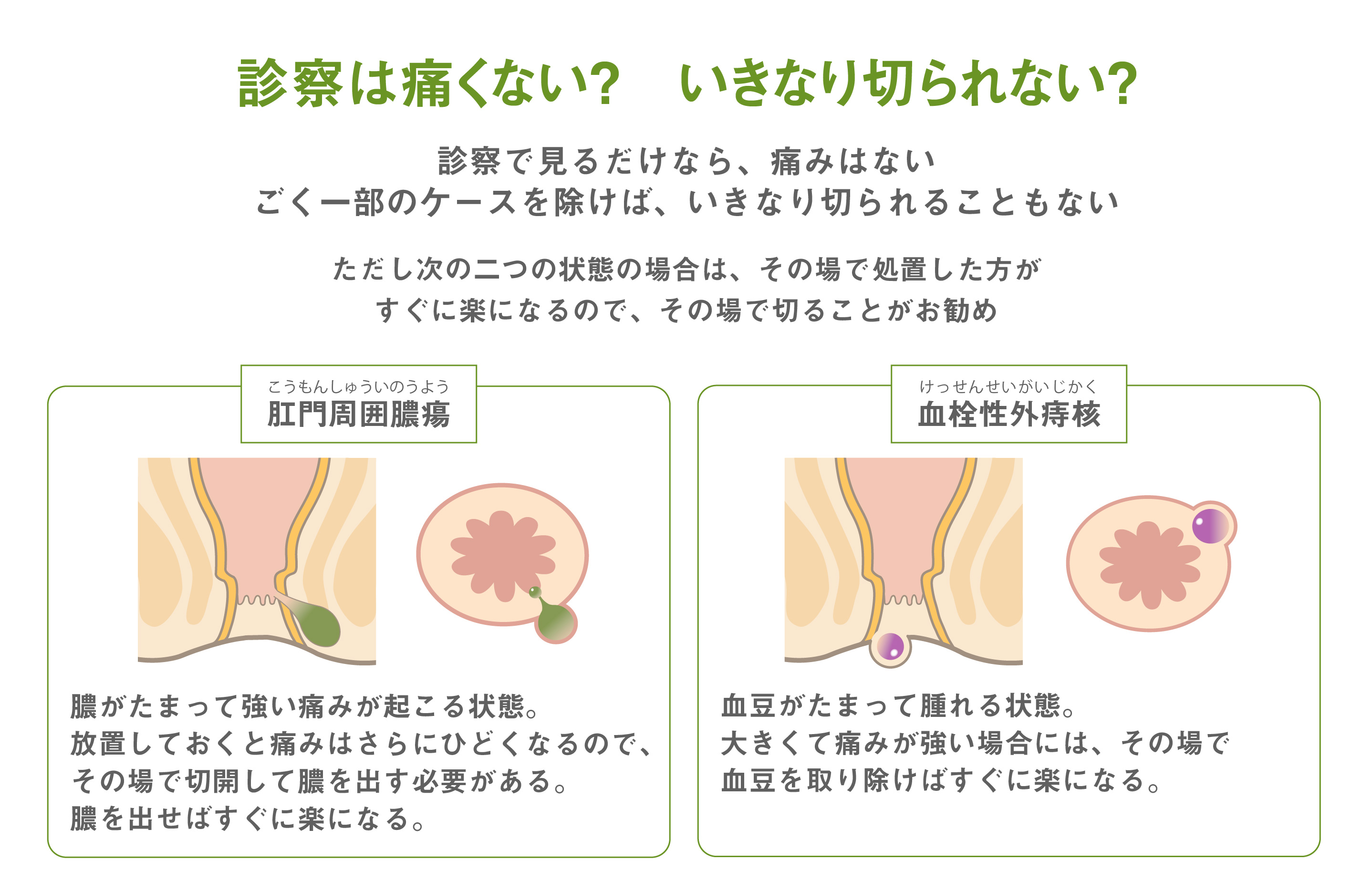 痔について むらた日帰り外科手術クリニック